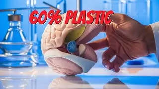 Alarmingly High Levels of Microplastics in Human Brains