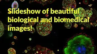 Slideshow of beautiful biological and medical images!