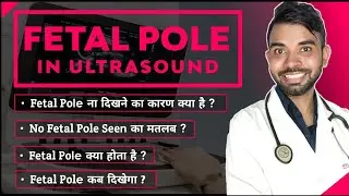 why fetal pole not seen | why fetal pole does not develop | fetal pole not seen, no fetal pole cause