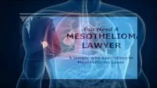 Asbestos Attorney | Mesothelioma Lawyers