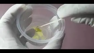 stool specimen collection