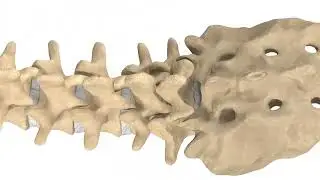 Minimally Invasive Transforaminal Interbody Fusion (TLIF)