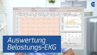 Belastungs-EKG / Auswertung in der custo diagnostic