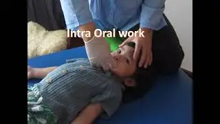 Intraoral Craniosacral Mouthwork