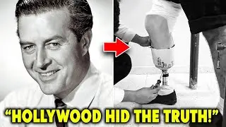 Golden Age Stars Who Secretly Hid Deformities and Disabilities