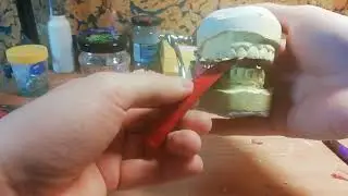 Technik dentystyczny - wykonanie protezy częściowej, Ustawianie zębów (partial denture)