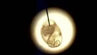 Physa acuta egg