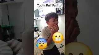 When Pulling Out Your Tooth Goes Wrong #fail #teeth #funny #crying #problems #subscribe