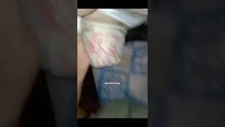 pantompainmasage amputeecommunity amputeemodel