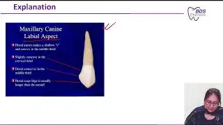 NEET MDS 2024 Endo : Ellis class I fracture