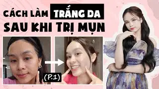 Bật mí CÁCH LÀM TRẮNG DA TỰ NHIÊN tại nhà sau khi TRỊ MỤN (P.1) | Hoàng Ngoan Beauty