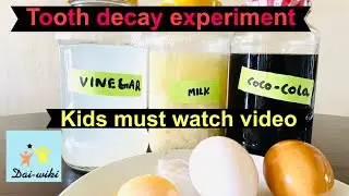 Tooth decay science experiment by Daiwik-importance of brushing  teeth || #kidsscienceexperiments
