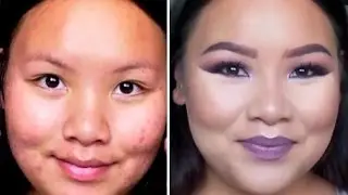 VAMPY Fallesque Makeup Tutorial + Acne Scar Coverage