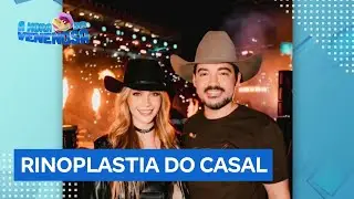 Fernando Zor reata com ex-noiva e comemora com cirurgia plástica no nariz