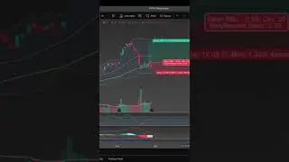 🚀 $PLTR Entry Breakdown | #trading #tradesetup #technology