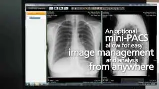 Carestream Vita Human CR Systems