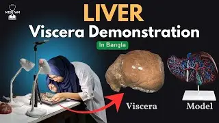 Liver Anatomy in Bangla| Liver Viscera Demonstration in Bangla | Abdomen | Anatomy | MedFam