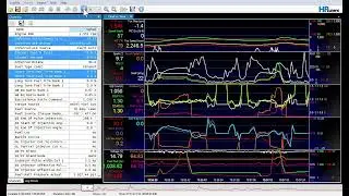 VCM Scanner  2022 Ford Mustang GT Coupe, 5 0 L, V8, Learning Flex Fuel log