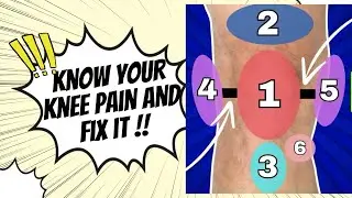 Prepatellar bursitis : cause anterior knee pain #kneepain #viralvideo #trending #trend #viral
