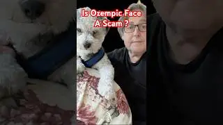 Do I Have Ozempic Face?