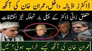ڈاکٹرز اڈیالہ داخل،عمران خان کی آنکھ سے متعلق ڈاکٹرز کے پہلی بار تہلکہ خیز انکشافات