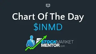Here's your trade on INMODE ($INMD)