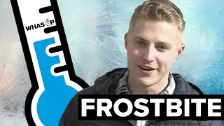 What does frostbite do to your body?