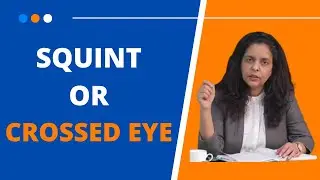 Squint or Crossed eye may lead to partial blindness I Paediatric Ophthalmologist in Noida