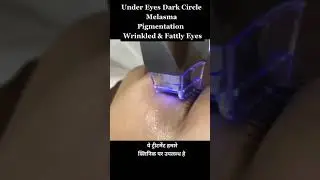 Under Eyes Dark Circle Treatment #Shorts