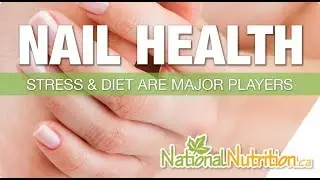 Natural Health Reviews - What Nails Say About Your Health? Nail Health Signs | National Nutrition
