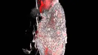 3DReconstruction Olfactory Bulb