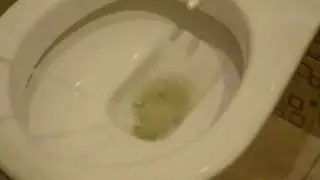 Foamy urine without proteinuria