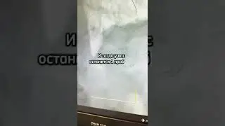 У вас может быть 1000 проблемы в жизни. Хорошее здоровье как карона!