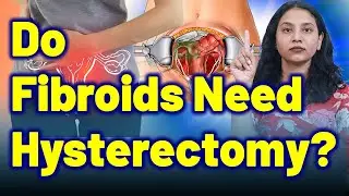 Robotic, Vaginal, Laparoscopic or Abdominal &ndash; Which Hysterectomy is safe for Fibroids? | Treatment