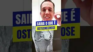 No v&iacute;deo de hoje explico sobre um caso de osteonecrose, ou seja, necrose no osso.