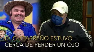 EL GUITARRE&Ntilde;O (ALFONSO ALEMAN) POR POCO PIERDE SU OJO TRAS ACCIDENTE