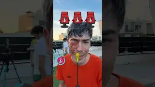 Cre&eacute;is que lo tengo muy mal?😱