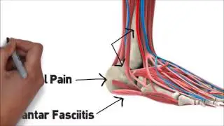 MSK Biomechanical Assessment