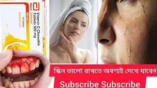 Limcee  vitamin c chewable tablets 500 mg Limcee tablets kaise use kare Limcee tablets Bengal