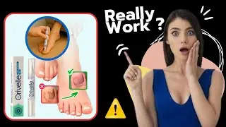 Orivelle Antifungal Pen Review - Legit for Toenail Fungus Or A Scam?