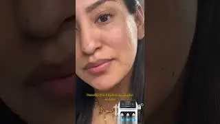 Deep Cleansing + Oxygen Hydration | Instant Glow Facial Results