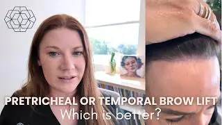 Temporal Brow Lift vs Pretricheal Brow Lift | Which Brow Lift Technique Is Best for You?