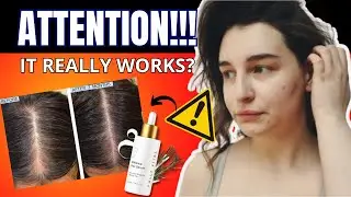 FULLY VITAL ENHANCE HAIR SERUM⚠️(UPDATE 2024)⚠️-Fully Vital Hair- Fully Vital Enhance Hair Reviews
