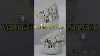 White Gold VS Silver On Diamond Grillz | MoissaniteBazaar.com