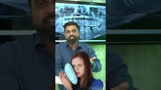 Are Dental Implants Painful ? | Dr Prem Alex Lawrence in Tamil