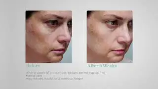 Murad Super-Size Rapid Age Spot Serum, 2 oz. on QVC