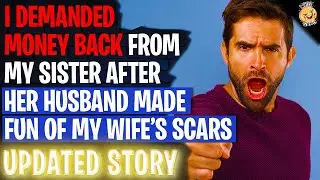 I DEMANDED Money Back From My Sister After Her Husband Made Fun Of My Wifes Scars | Reading Reddit