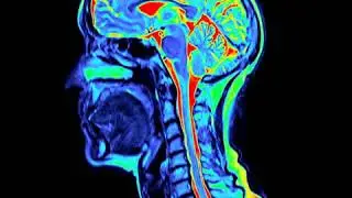 Colored sagittal MRI scan