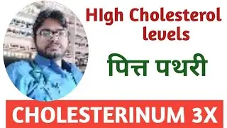 Cholesterinum 3x Homeopathic Medicine/High Cholesterol Levels/पित्त पथरी/Dr Sarvesh Kumar/hindi 
