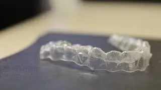 Braces Alternatives - Main Line Pa